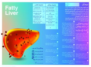 تصویر مربوط به مقاله کبد چرب- انتشارات حک